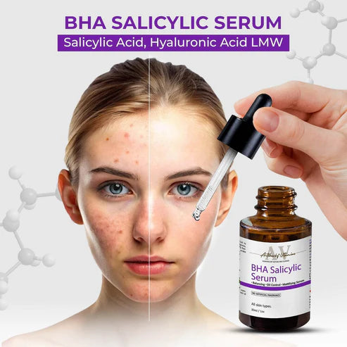 BHA Salicylic Serum For Oil Control - 10ml | Face Serum for Oily skin, Spot Marks and Deep Hydration | For All Type Skin